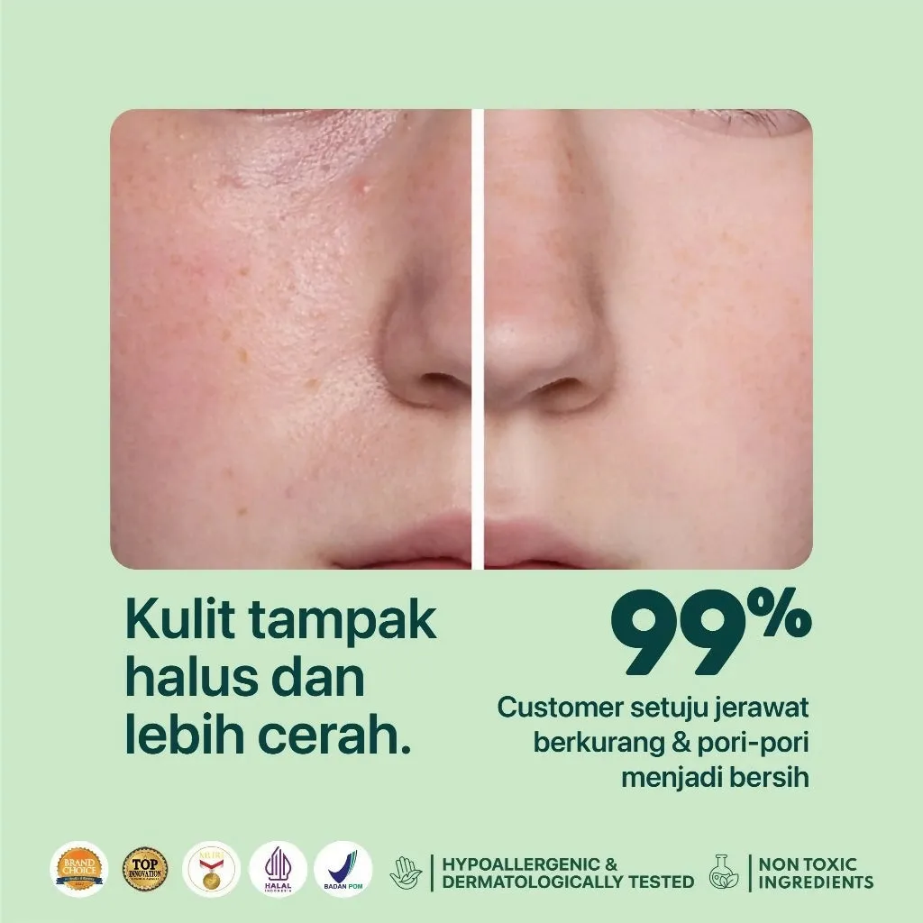 NPURE Toner Cica Acne Toner 30ml / Acne Toner / Toner Kulit Jerawat Berminyak - Travel Size Acid Berjerawat Hydrating Mencerahkan Wajah Kotoran