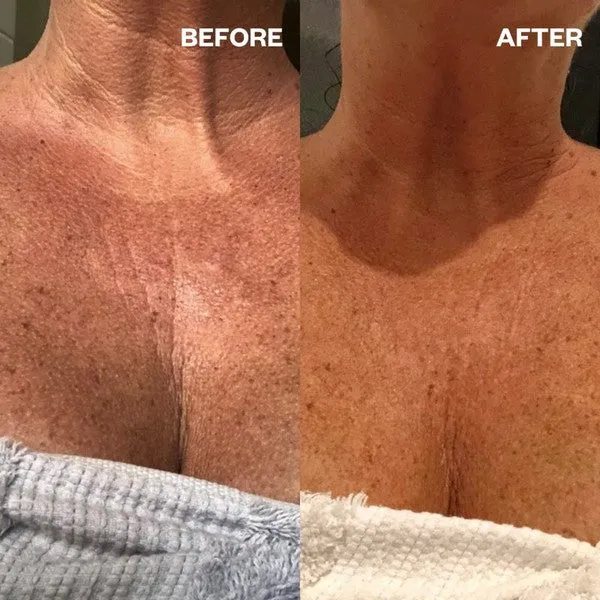 Wrinkles Schminkles Décolletage Brightening Sheet Mask - 1 Mask
